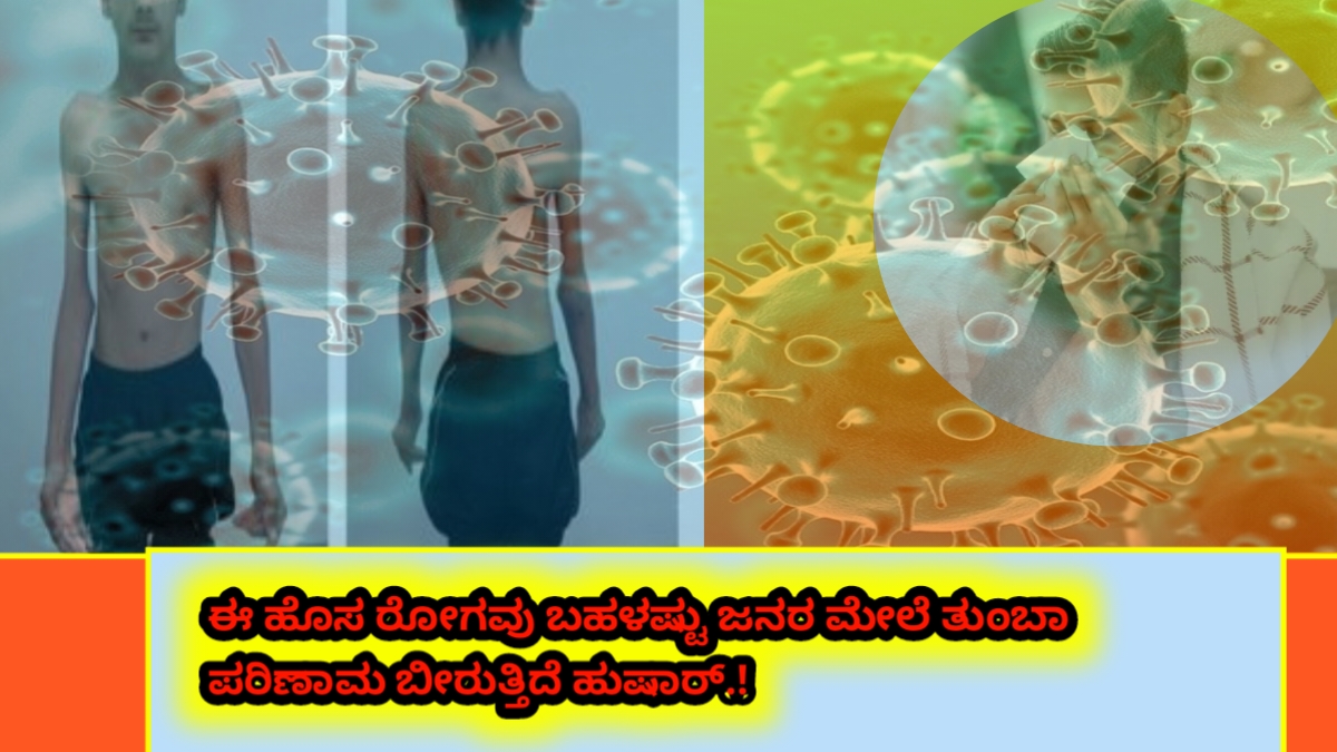 New disease people beware: This disease is affecting a lot of people. Here is the complete details about this disease.